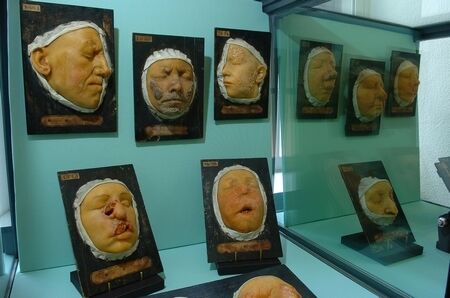 musee instrument medecine cires anatomiques TOULOUSE
