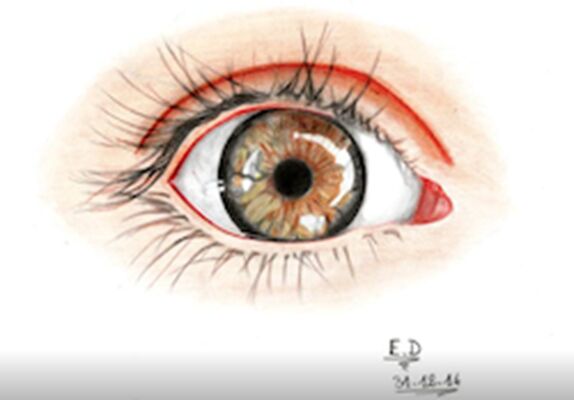 Exposition "Les Dessins d'Eric"